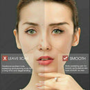 Mole Removal Pen Portable Skin Tag Repair Kit Face Care Skin Removal Freckle Wart dark Spot Remover - Tavice
