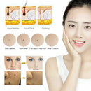 Mole Removal Pen Portable Skin Tag Repair Kit Face Care Skin Removal Freckle Wart dark Spot Remover - Tavice